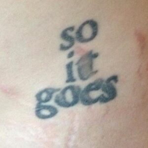 Effect of stretch marks on tattoo.